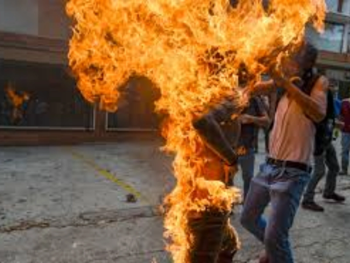 Bénin : un présumé voleur de vin de palme brûlé vif à Avrankou